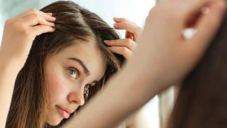 hair loss